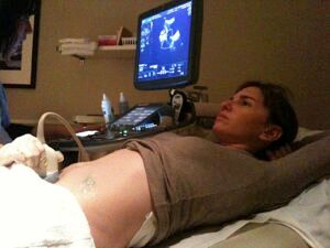Medical ultrasound examination of a pregnant woman.