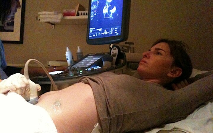 Medical ultrasound examination of a pregnant woman.