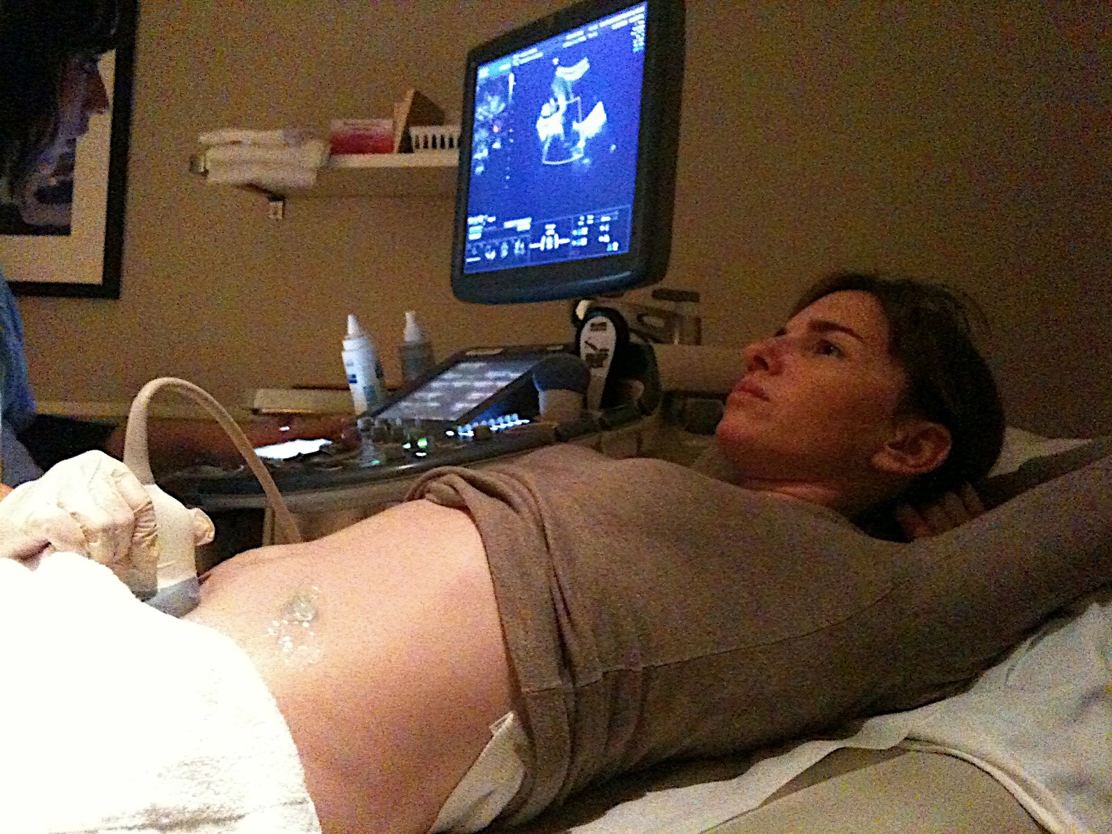 Medical ultrasound examination of a pregnant woman.